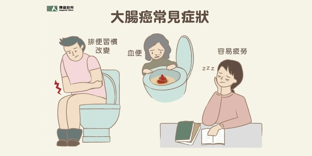 大腸癌症狀有哪些?從早期到晚期，專業醫師帶你全面認識大腸癌